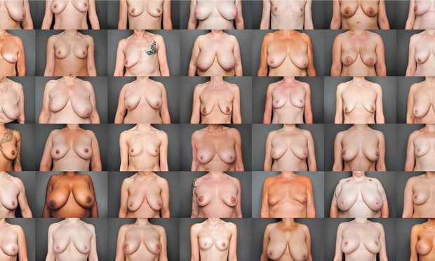 vrouwen met unieke lichamen en borsten